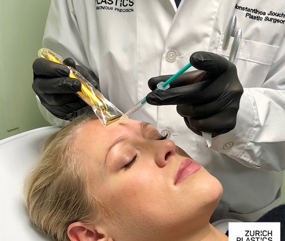 Faltenbehandlung in Zürich, Teil 1 – Botox® bzw. Botulinumtoxin A