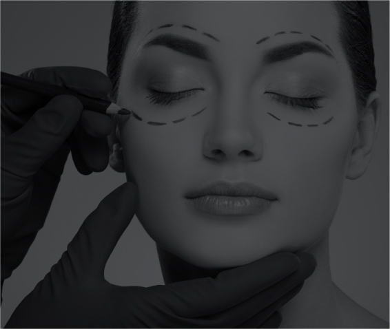 Blepharoplasty (Eyelid Surgery)