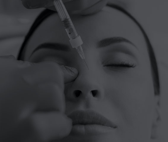 Non-Surgical Rhinoplasty with Hyaluronic Acid