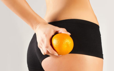 The relationship between cellulite, exercise & nutrition