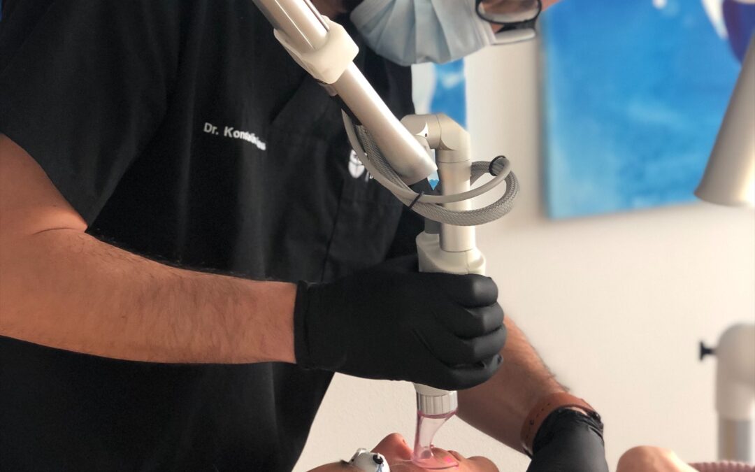 CO2 Fraxel Laser Saison bei Zurich Plastics hat wieder begonnen