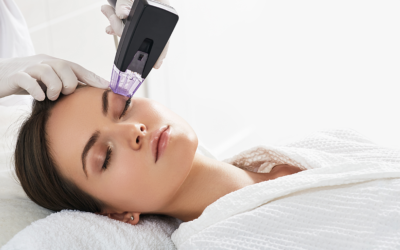 MORPHEUS 8™ RF DEEP Microneedling